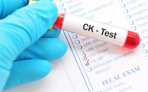 Rękawiczka trzyma probówkę z krwią do testu CK. Na formularzu zaznaczono kinazę kreatynową 400.